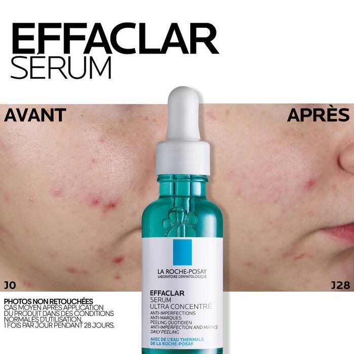 La Roche-Posay Effaclar Sérum à l’Acide Salicylique Ultra Concentré 30 ml – Image 5